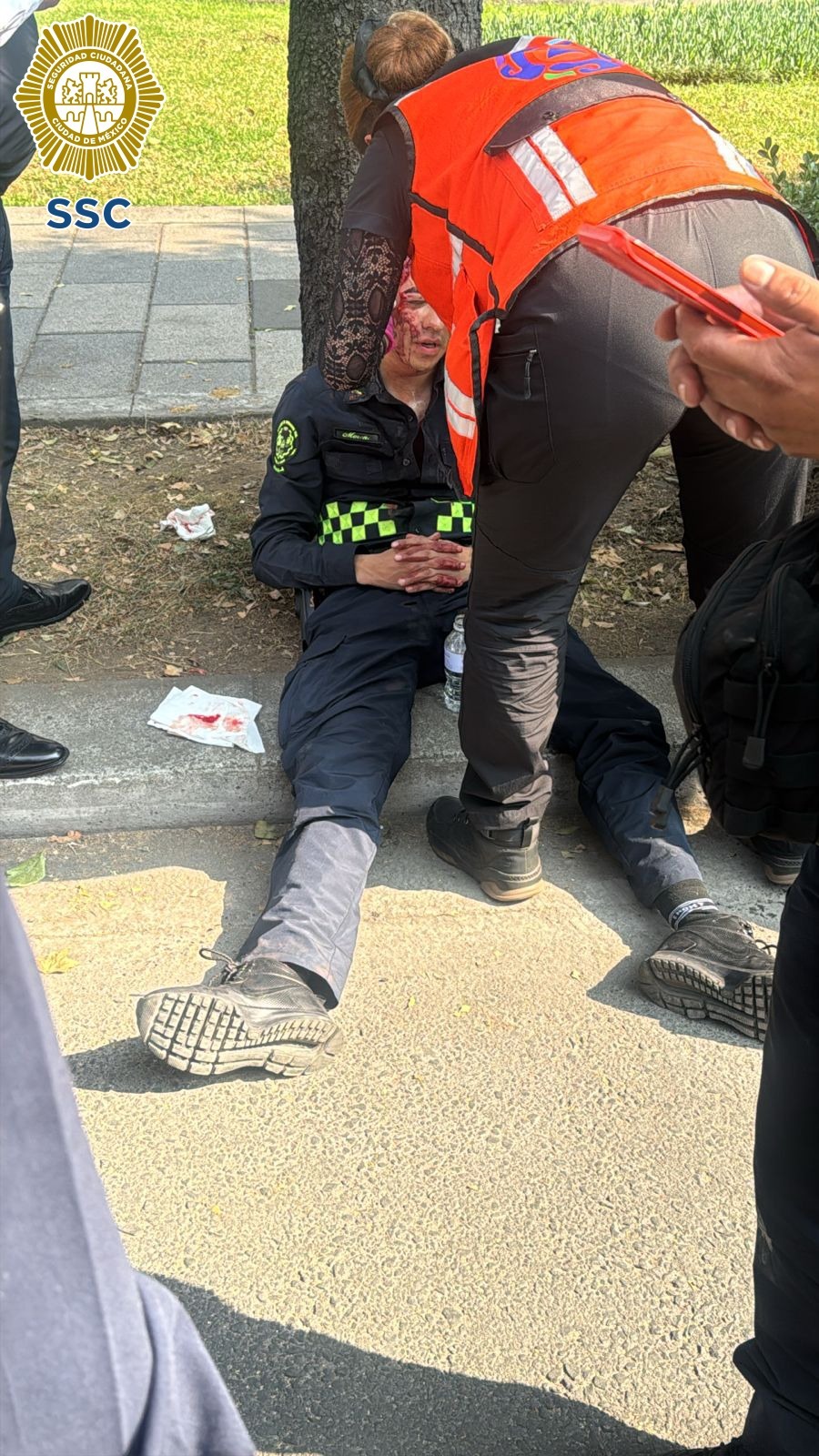Joven motociclista es detenido por arrollar a un policía en la Benito ...